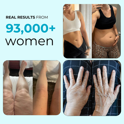 Anti-Cellulite & Lipedema Capsules by Auralea™