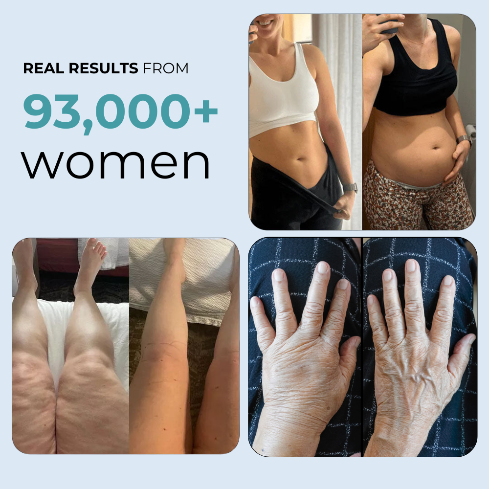 Lymphatic Drainage Capsules by Auralea™ (uk)